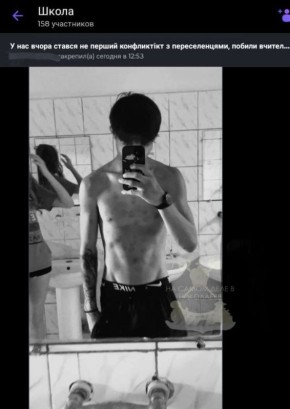 В Николаевской области очередной «успех» гуманной политики властей