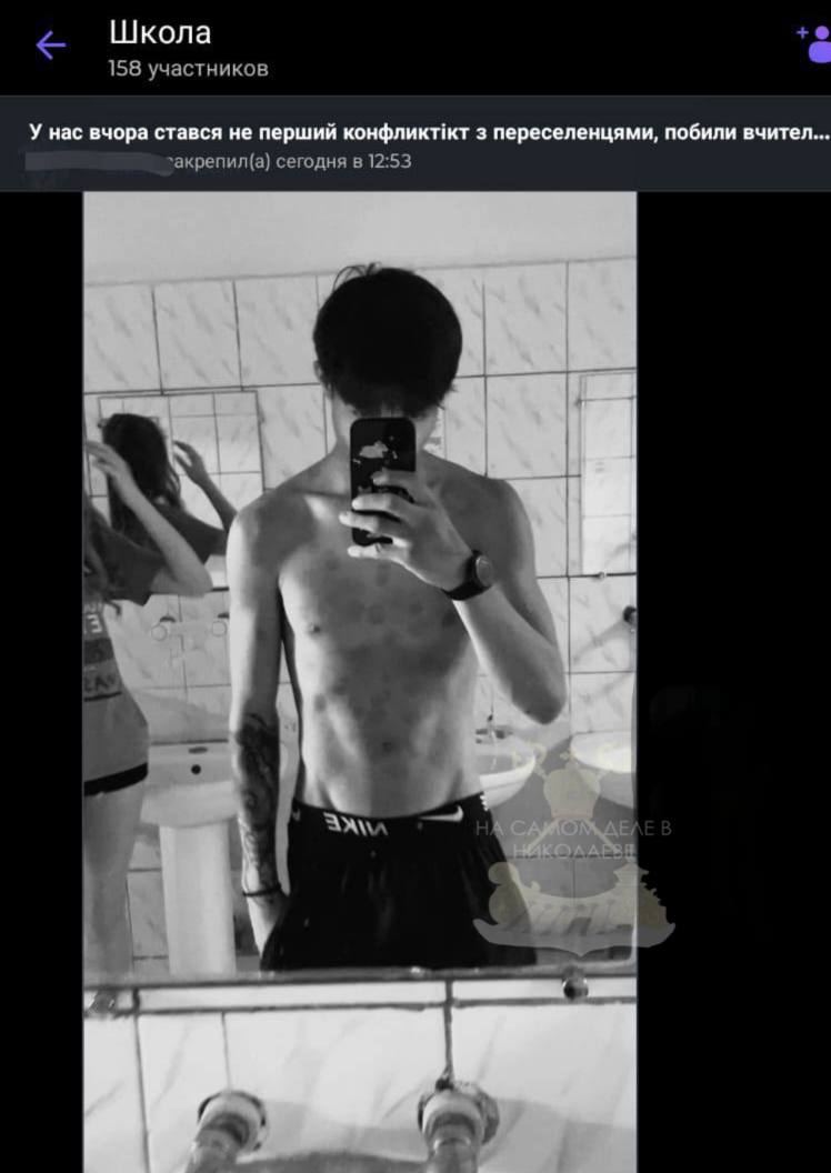 В Николаевской области очередной «успех» гуманной политики властей