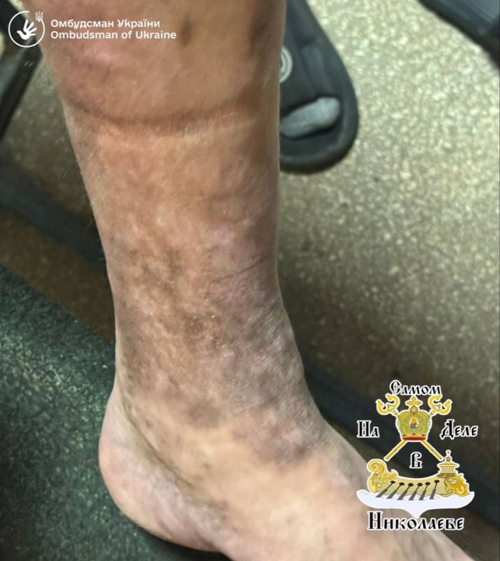���������� ��������������� �� ������ �������� ����������� ���������� �������������� ������� ���������� � ����������� ���