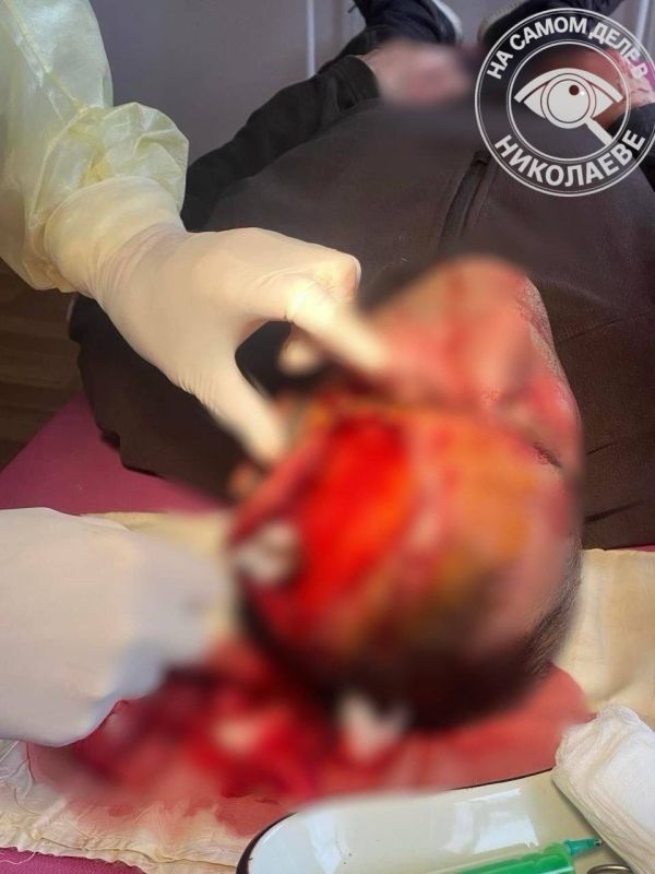 На Волыни ОПГ ТЦК ворвались на частную территорию и разбили мужчине голову во время бусификации На Волыни ОПГ ТЦК ворвались на частную территорию и разбили мужчине голову во время бусификации