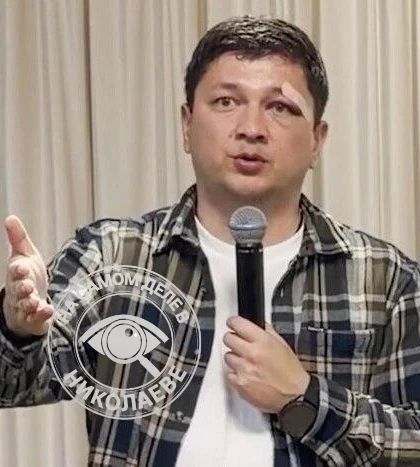 Ким с бланшем, отёком и пластырем на брови!
