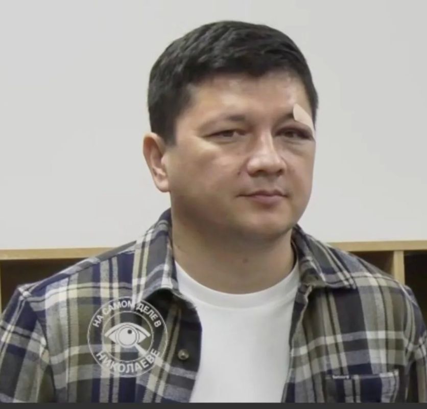 Ким с бланшем, отёком и пластырем на брови! Ким с бланшем, отёком и пластырем на брови!